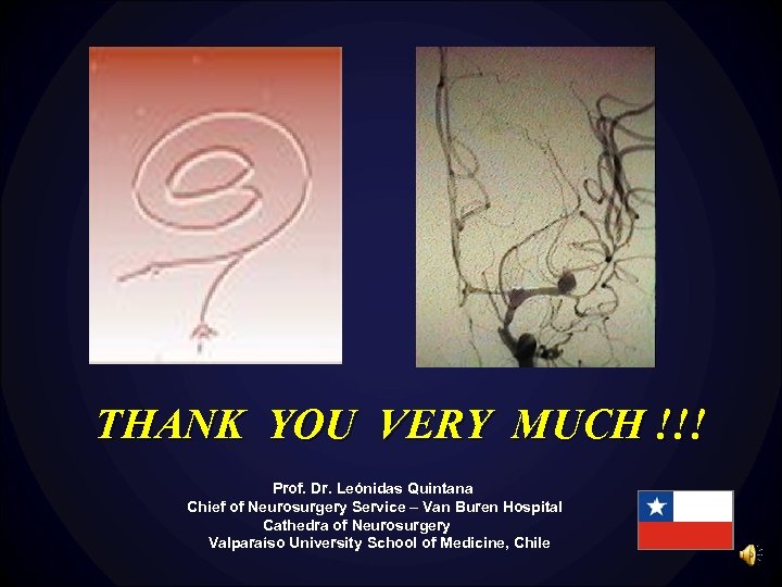 THANK YOU VERY MUCH !!! Prof. Dr. Leónidas Quintana Chief of Neurosurgery Service –