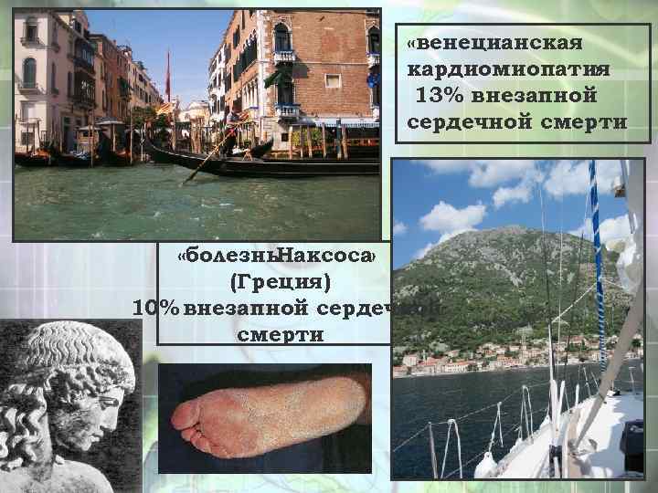  «венецианская кардиомиопатия » 13% внезапной сердечной смерти «болезнь. Наксоса » (Греция) 10% внезапной