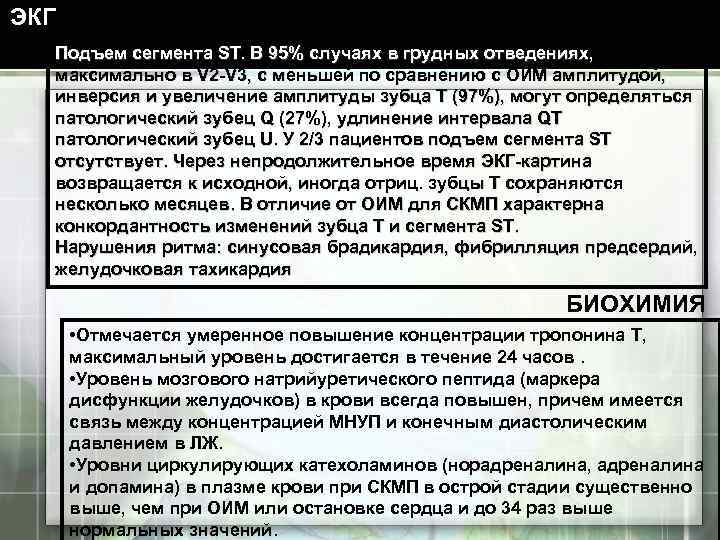 ЭКГ Подъем сегмента ST. В 95% случаях в грудных отведениях, максимально в V 2