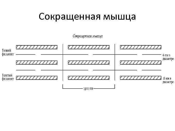Сокращенная мышца 
