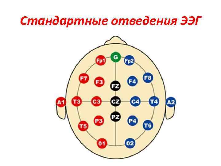 Стандартные отведения ЭЭГ 