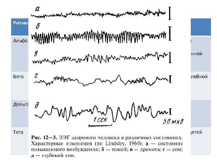 Ритмы Частота (Гц) Амплитуда (мк. В) Характеристика Альфа 8 -13 30 -100 Симметричный, синусообразной
