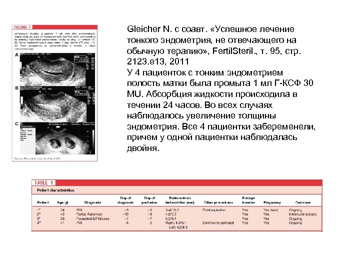 Gleicher N. с соавт. «Успешное лечение тонкого эндометрия, не отвечающего на обычную терапию» ,