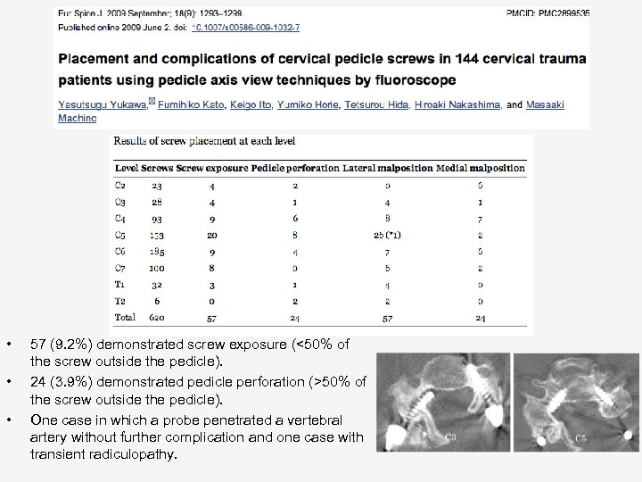  • • • 57 (9. 2%) demonstrated screw exposure (<50% of the screw