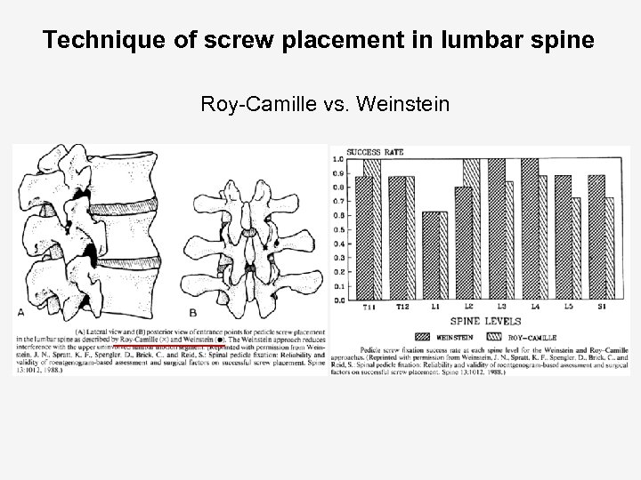 Technique of screw placement in lumbar spine Roy-Camille vs. Weinstein 