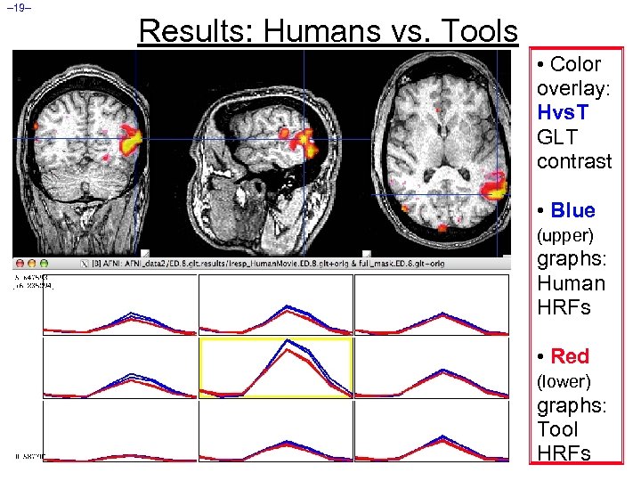 – 19– Results: Humans vs. Tools • Color overlay: Hvs. T GLT contrast •