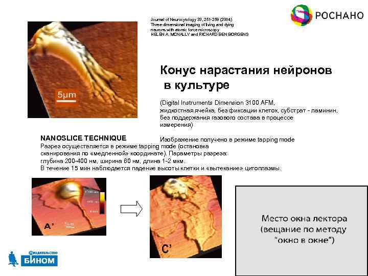 Journal of Neurocytology 33, 251 -258 (2004) Three-dimensional imaging of living and dying neurons