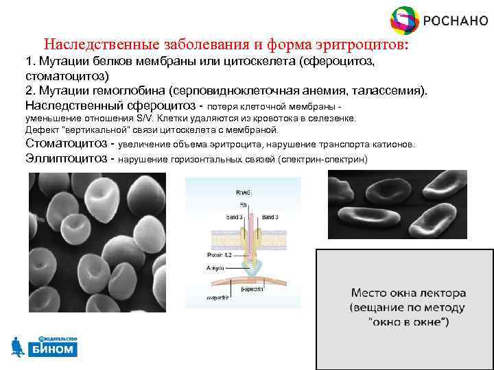 Заболевания белок. Наследственные дефекты мембраны эритроцитов. Наследственные дефекты мембраны эритроцитов приводят к. Заболевания связанные с нарушением обмена в эритроцитах. Наследственный сфероцитоз связан с мутацией в гене.