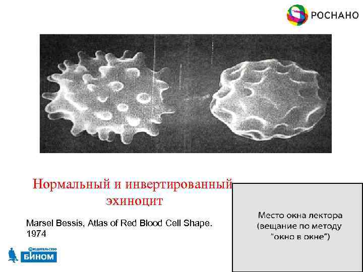 Нормальный и инвертированный эхиноцит Marsel Bessis, Atlas of Red Blood Cell Shape. 1974 