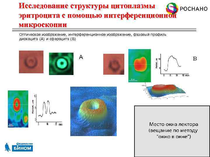 Исследование структуры цитоплазмы эритроцита с помощью интерференционной микроскопии Оптическое изображение, интерференционное изображение, фазовый профиль