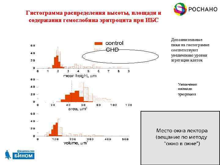 Гистограмма распределения высоты, площади и содержания гемоглобина эритроцита при ИБС Дополнительные пики на гистограмме