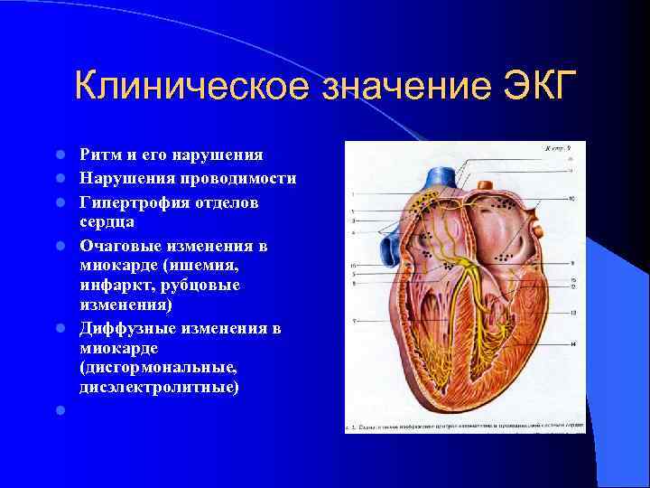 Клиническое значение ЭКГ l l l Ритм и его нарушения Нарушения проводимости Гипертрофия отделов