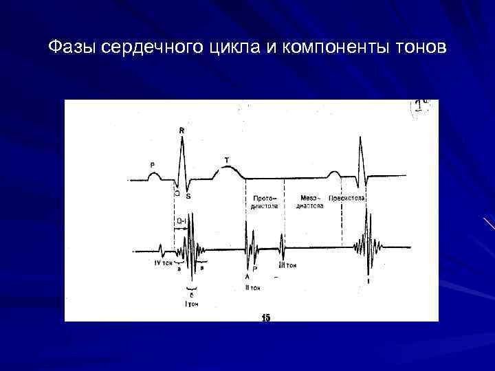 Фазы сердечного цикла и компоненты тонов 