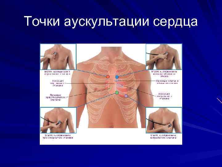 Точки аускультации сердца 