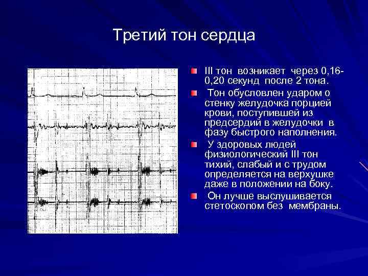 Третий тон сердца III тон возникает через 0, 160, 20 секунд после 2 тона.