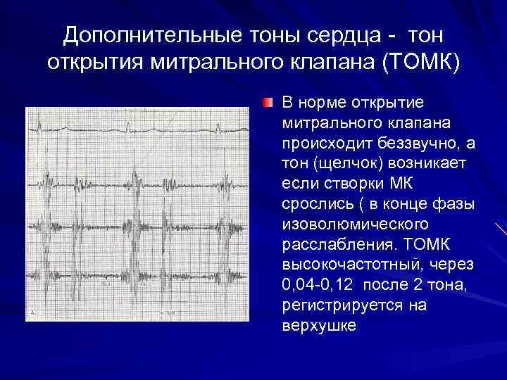 Допплерометрия трикуспидального клапана норма