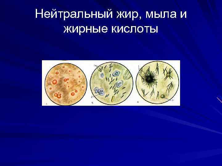 Нейтральный жир, мыла и жирные кислоты 