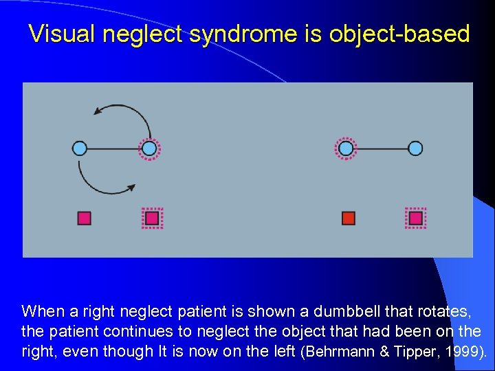 Visual neglect syndrome is object-based When a right neglect patient is shown a dumbbell