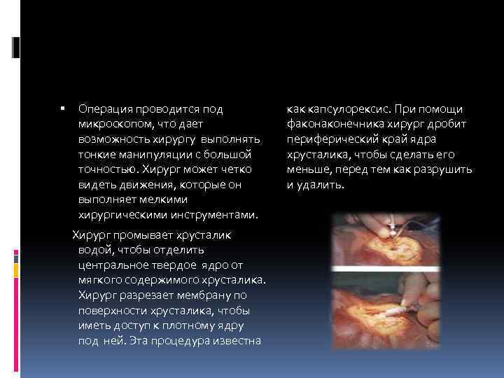  Операция проводится под микроскопом, что дает возможность хирургу выполнять тонкие манипуляции с большой