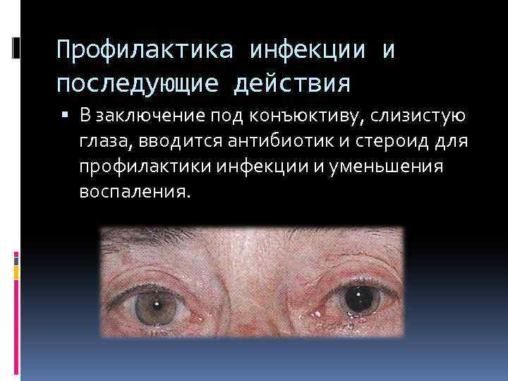 Профилактика инфекции и последующие действия В заключение под конъюктиву, слизистую глаза, вводится антибиотик и