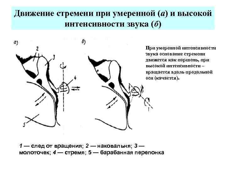 Движение стремени при умеренной (а) и высокой интенсивности звука (б) При умеренной интенсивности звука