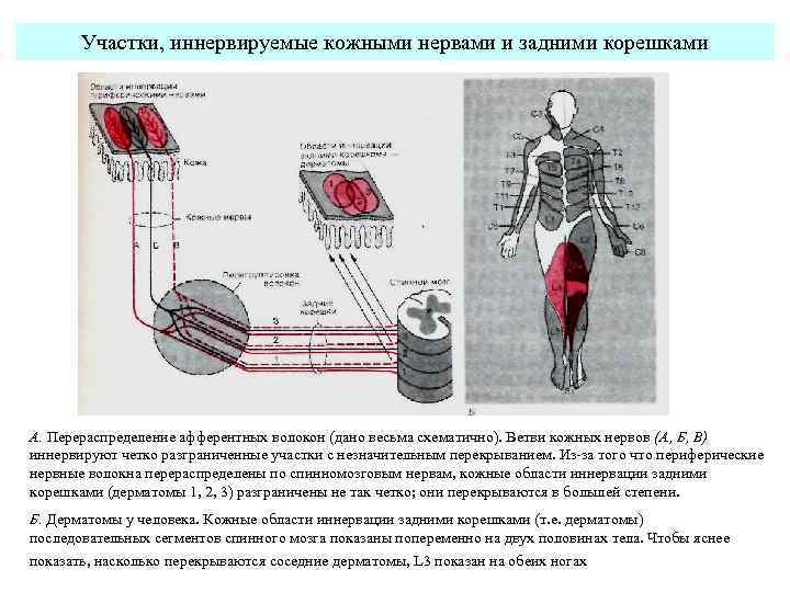 Участки, иннервируемые кожными нервами и задними корешками А. Перераспределение афферентных волокон (дано весьма схематично).