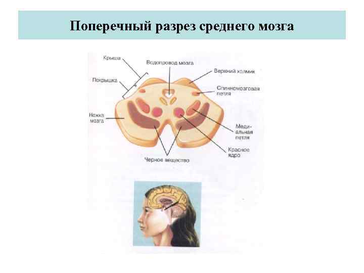 Поперечный срез среднего мозга схема