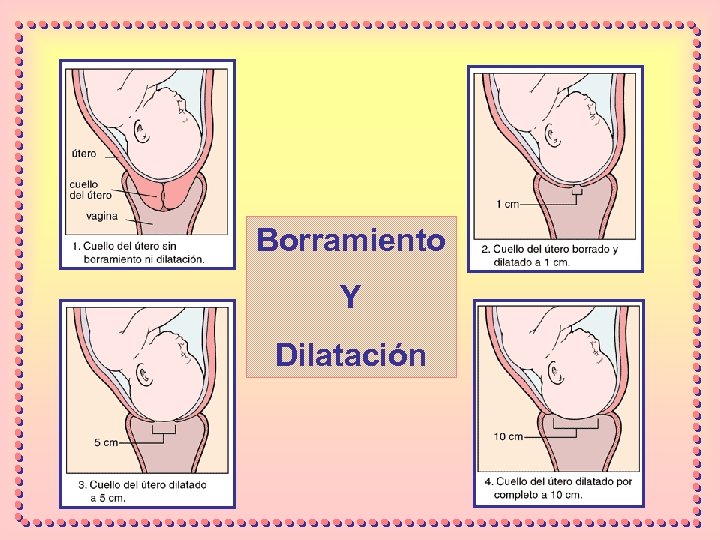 Borramiento Y Dilatación 