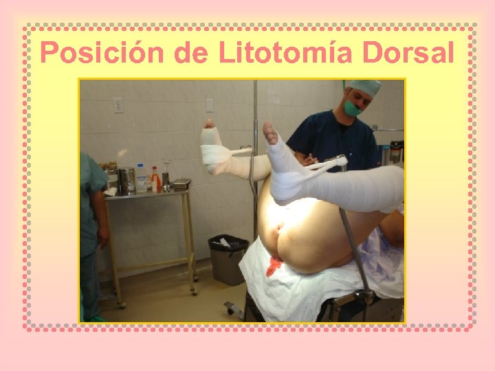 Posición de Litotomía Dorsal 
