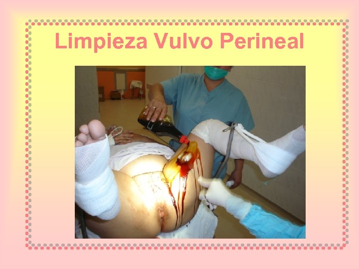 Limpieza Vulvo Perineal 