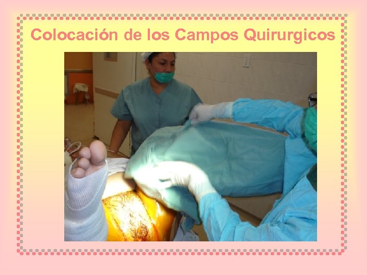 Colocación de los Campos Quirurgicos 