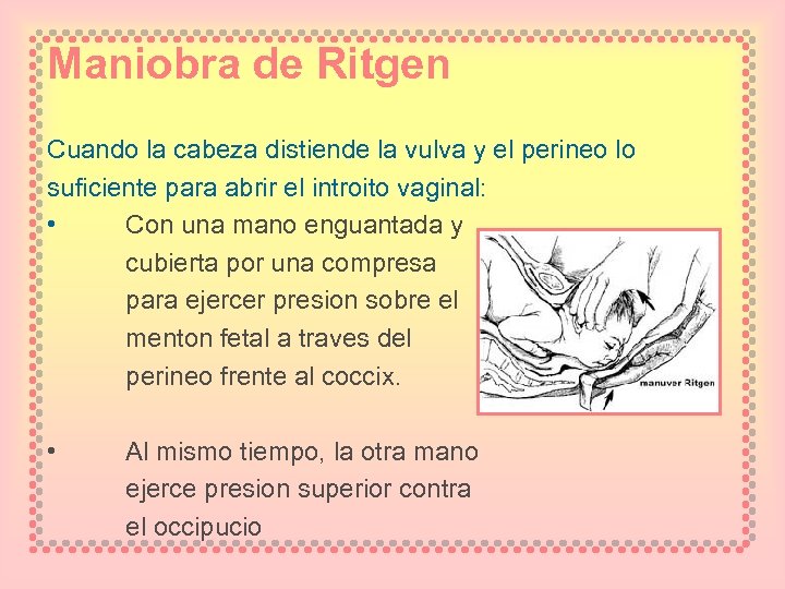 Maniobra de Ritgen Cuando la cabeza distiende la vulva y el perineo lo suficiente