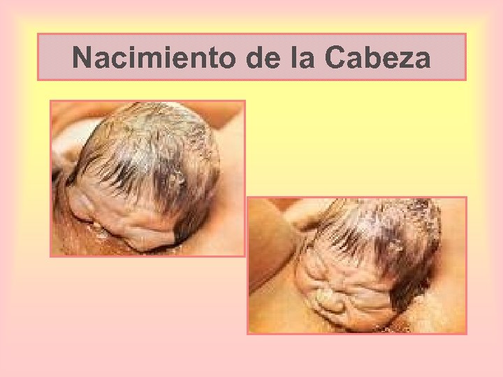 Nacimiento de la Cabeza 