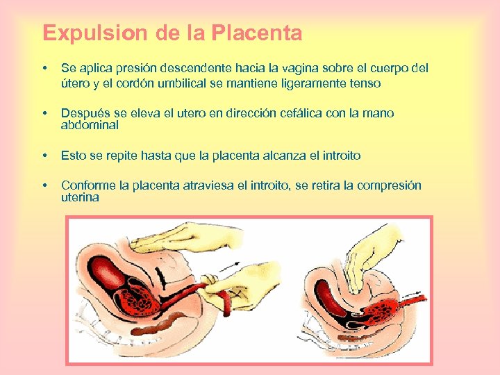 Expulsion de la Placenta • Se aplica presión descendente hacia la vagina sobre el