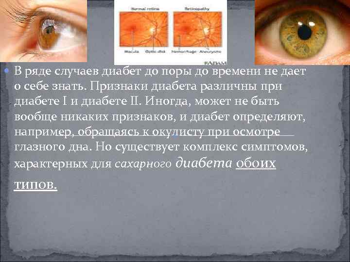  В ряде случаев диабет до поры до времени не дает о себе знать.