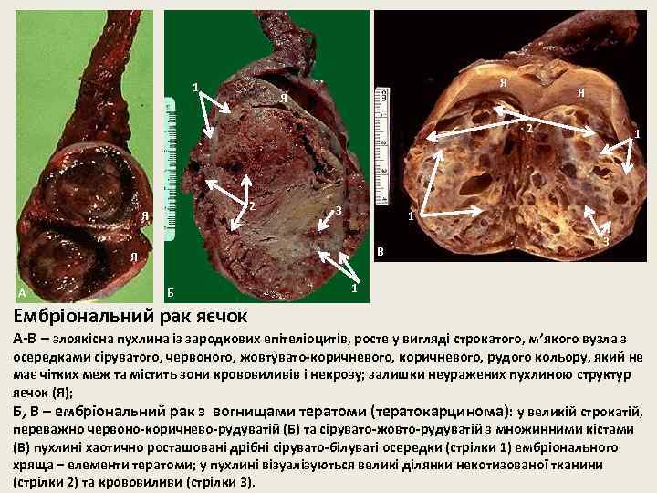 1 Я Я Я 2 2 Я 3 1 В Я А Б 1