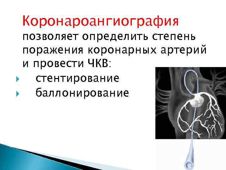 Коронароангиография позволяет определить степень поражения коронарных артерий и провести ЧКВ: стентирование баллонирование 
