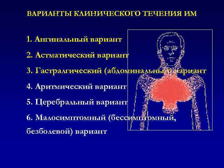 ВАРИАНТЫ КЛИНИЧЕСКОГО ТЕЧЕНИЯ ИМ 1. Ангинальный вариант 2. Астматический вариант 3. Гастралгический (абдоминальный) вариант