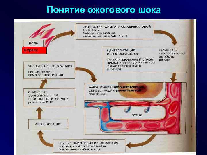 Картина ожогового шока при глубоких ожогах развивается при поражении поверхности тела