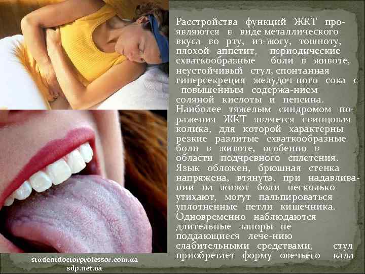  Расстройства функций ЖКТ про studentdoctorprofessor. com. ua sdp. net. ua являются в виде