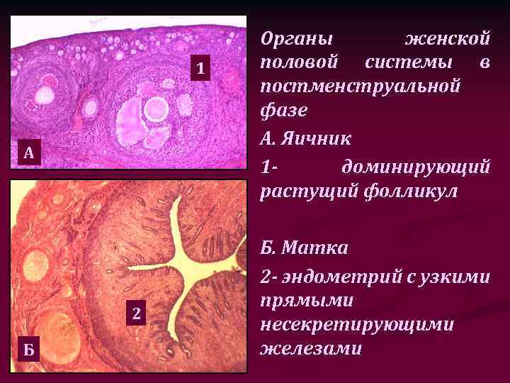 1 А 2 Б Органы женской половой системы в постменструальной фазе А. Яичник 1