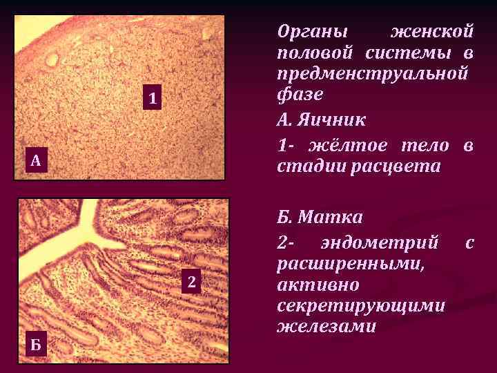 Органы женской половой системы в предменструальной фазе А. Яичник 1 - жёлтое тело в