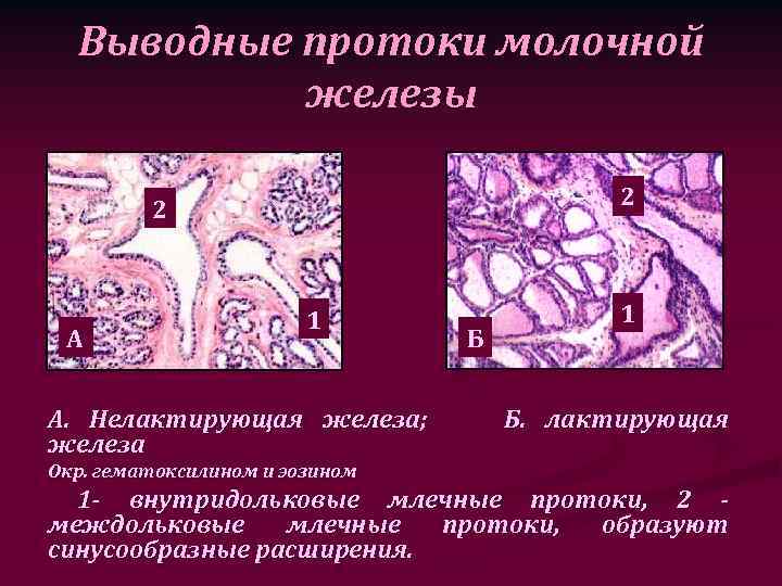 Закупорка протока молочной железы фото