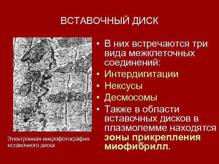 ВСТАВОЧНЫЙ ДИСК Электронная микрофотография вставочного диска • В них встречаются три вида межклеточных соединений: