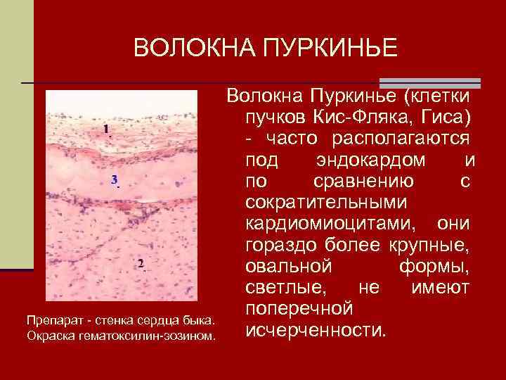 ВОЛОКНА ПУРКИНЬЕ Препарат - стенка сердца быка. Окраска гематоксилин-эозином. Волокна Пуркинье (клетки пучков Кис-Фляка,