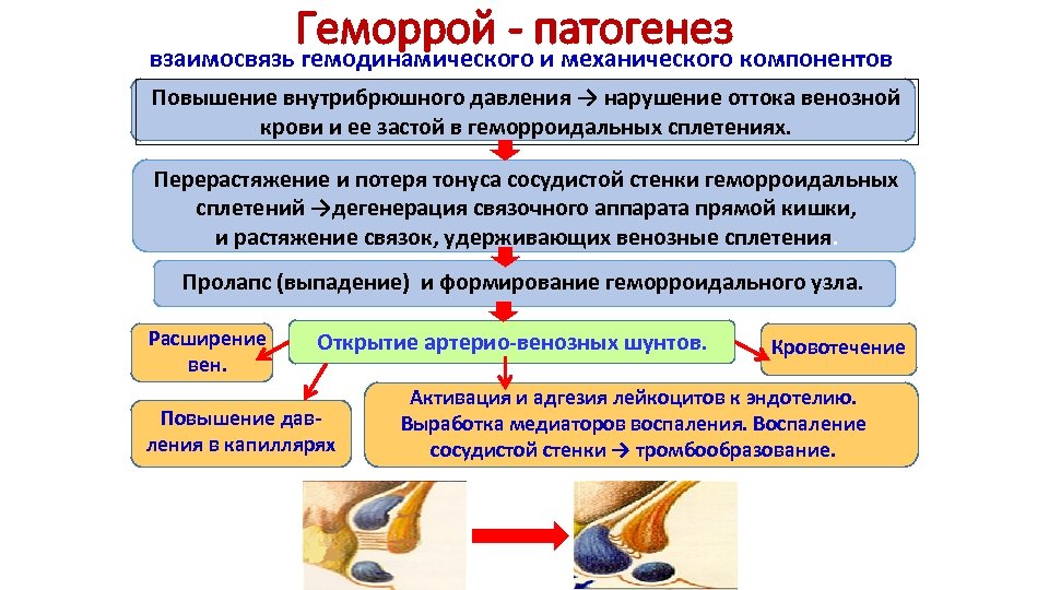 Геморрой - патогенез компонентов взаимосвязь гемодинамического и механического Повышение внутрибрюшного давления → нарушение оттока