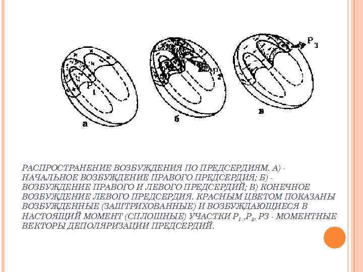 РАСПРОСТРАНЕНИЕ ВОЗБУЖДЕНИЯ ПО ПРЕДСЕРДИЯМ. А) НАЧАЛЬНОЕ ВОЗБУЖДЕНИЕ ПРАВОГО ПРЕДСЕРДИЯ; Б) ВОЗБУЖДЕНИЕ ПРАВОГО И ЛЕВОГО