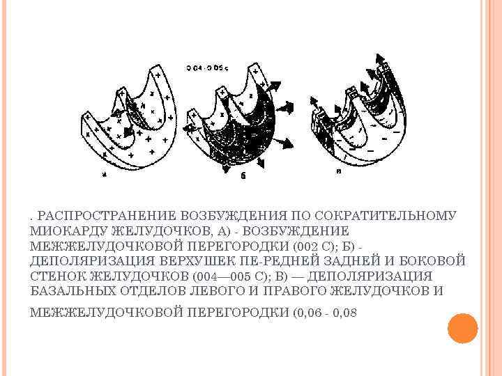 . РАСПРОСТРАНЕНИЕ ВОЗБУЖДЕНИЯ ПО СОКРАТИТЕЛЬНОМУ МИОКАРДУ ЖЕЛУДОЧКОВ, А) ВОЗБУЖДЕНИЕ МЕЖЖЕЛУДОЧКОВОЙ ПЕРЕГОРОДКИ (002 С); Б)