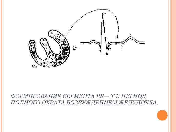 ФОРМИРОВАНИЕ СЕГМЕНТА RS— Т В ПЕРИОД ПОЛНОГО ОХВАТА ВОЗБУЖДЕНИЕМ ЖЕЛУДОЧКА. 