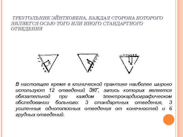 ТРЕУГОЛЬНИК ЭЙНТХОВЕНА, КАЖДАЯ СТОРОНА КОТОРОГО ЯВЛЯЕТСЯ ОСЬЮ ТОГО ИЛИ ИНОГО СТАНДАРТНОГО ОТВЕДЕНИЯ В настоящее